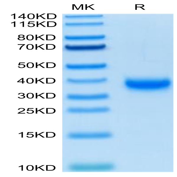 Biotinylated SARS-COV-2 Spike RBD Protein (COV-VM4BDB)