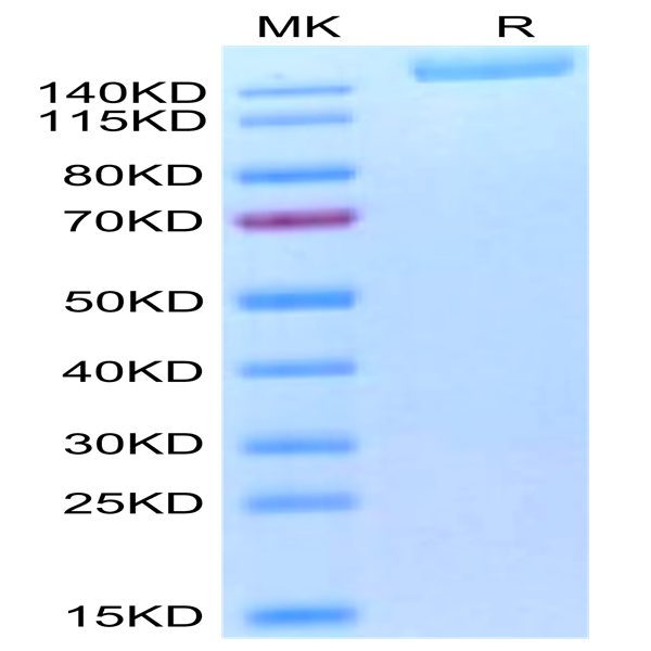 Biotinylated SARS-COV-2 Spike S (Omicron B.1.1.529) Trimer Protein (COV-VM4FOB)