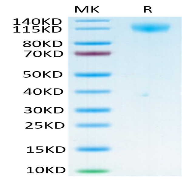 Biotinylated SARS-COV-2 Spike S1 Protein (COV-VM4S1B)