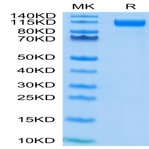 SARS-COV-2 Spike S1 (D614G) Protein (COV-VM4SG)