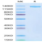 SARS-COV-2 Spike S Trimer Protein (COV-VM4SS)