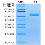 Human CPM Protein (CPM-HM101)