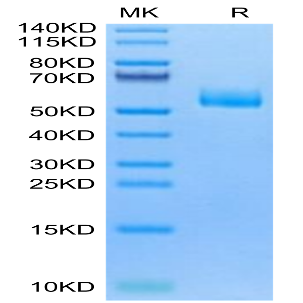Human CPM Protein (CPM-HM101)