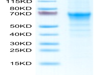 Mouse CRTAM Protein (CRM-MM101)