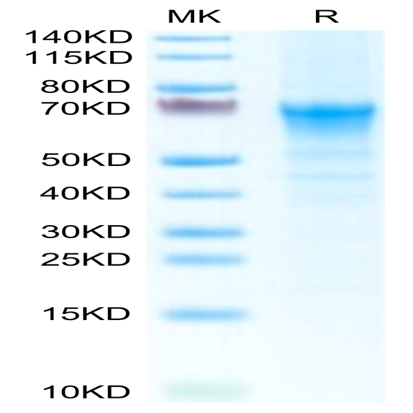 Mouse CRTAM Protein (CRM-MM101) Mouse CRTAM Protein (CRM-MM101)