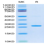 Cynomolgus C-Reactive Protein /CRP Protein (CRP-CM102)