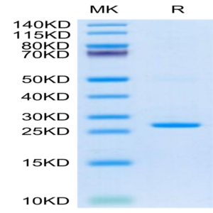 Cynomolgus C-Reactive Protein /CRP Protein (CRP-CM102)
