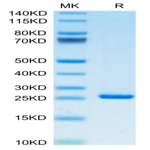 Human C-Reactive Protein /CRP Protein (CRP-HM101)