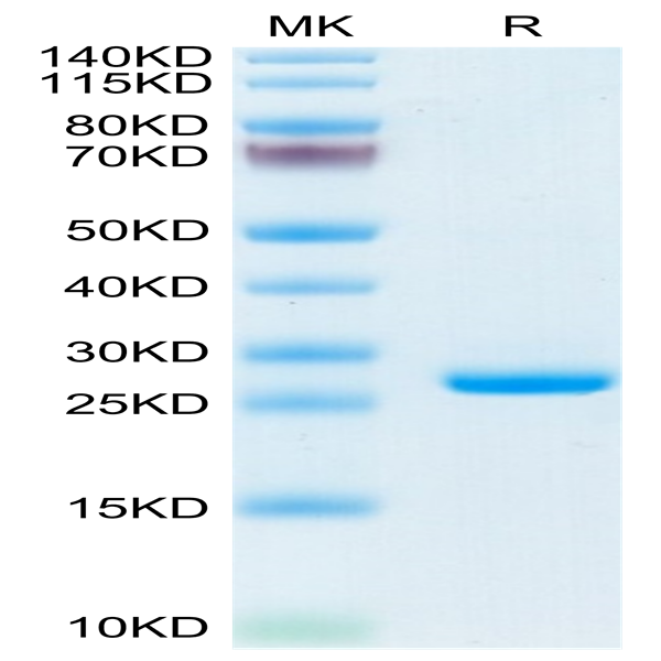 Mouse C-Reactive Protein/CRP Protein (CRP-MM101)