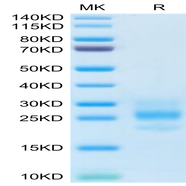 Human M-CSF/CSF-1 Protein (CSF-HM001)