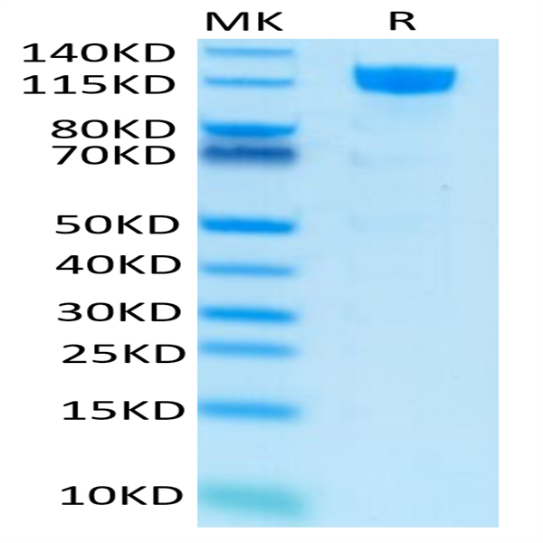 Human M-CSF R/CSF1R/CD115 Protein (CSF-HM21R)