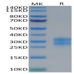 Human M-CSF/CSF-1 Protein (CSF-HM401)