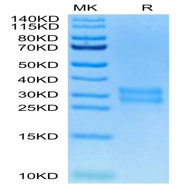Biotinylated Human M-CSF/CSF-1 Protein (CSF-HM401B)