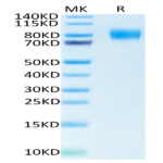 Biotinylated Human M-CSF R/CSF1R/CD115 Protein (CSF-HM41RB)