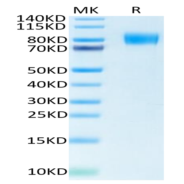 Biotinylated Human M-CSF R/CSF1R/CD115 Protein (CSF-HM41RB)