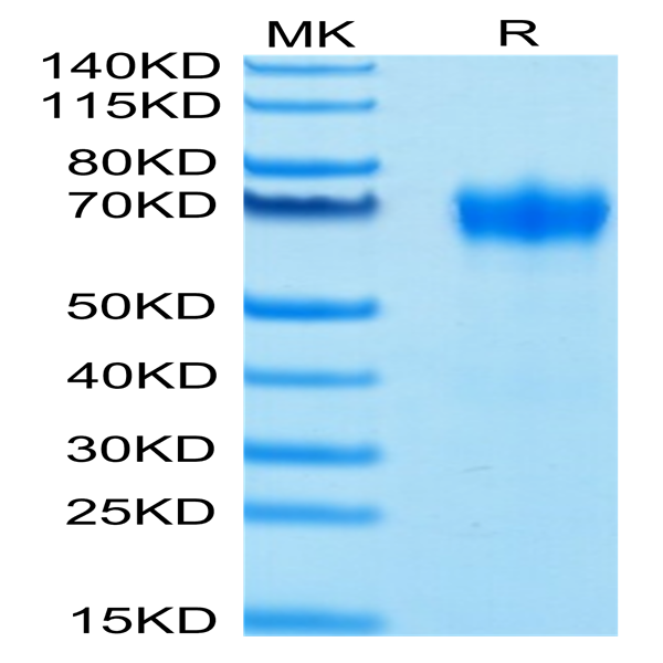 Biotinylated Human GM-CSF R alpha Protein (CSF-HM42RB)