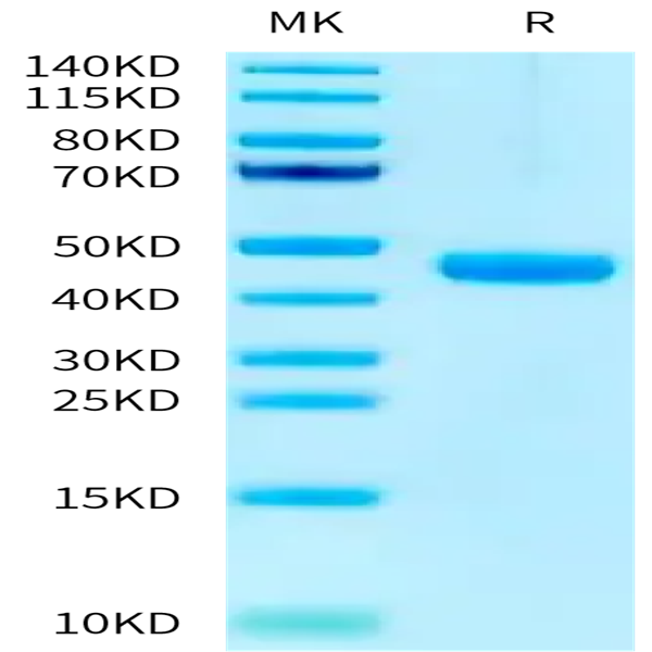 Mouse Cathepsin H Protein (CSH-MM101)