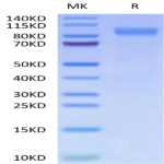 Cynomolgus CSPG4/MCSP Protein (CSP-CM1P4)