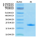 SARS-COV-2 Nucleocapsid Protein CTD Domain Protein (CTD-VE4NP)