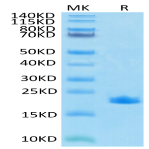 SARS-COV-2 Nucleocapsid Protein CTD Domain Protein (CTD-VE4NP)