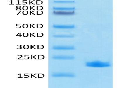 SARS-COV-2 Nucleocapsid Protein CTD Domain Protein (CTD-VE4NP)