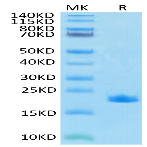 SARS-COV-2 Nucleocapsid Protein CTD Domain Protein (CTD-VE4NP) SARS-COV-2 Nucleocapsid Protein CTD Domain Protein (CTD-VE4NP)
