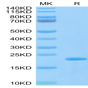 Biotinylated SARS-COV-2 Nucleocapsid Protein CTD Domain Protein (CTD-VE4NPB)