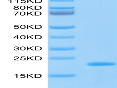 Biotinylated SARS-COV-2 Nucleocapsid Protein CTD Domain Protein (CTD-VE4NPB)