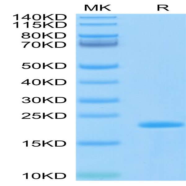 Biotinylated SARS-COV-2 Nucleocapsid Protein CTD Domain Protein (CTD-VE4NPB) Biotinylated SARS-COV-2 Nucleocapsid Protein CTD Domain Protein (CTD-VE4NPB)