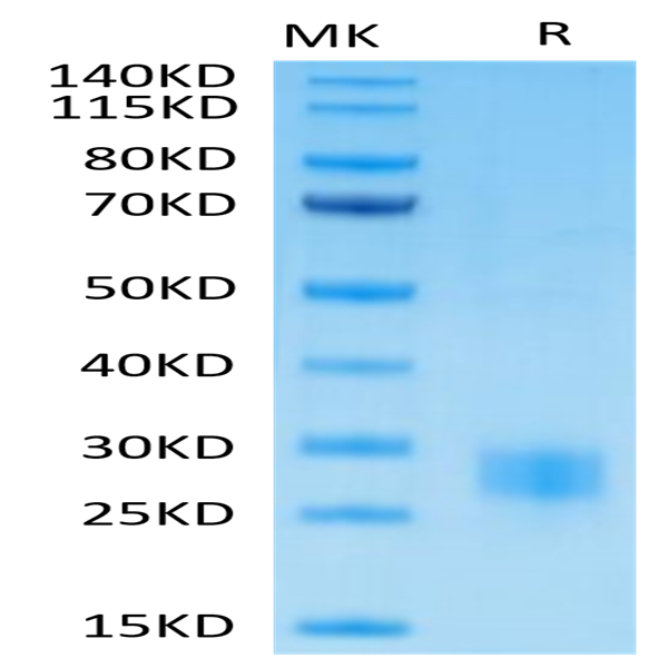 Biotinylated Human CTLA-4/CD152 Protein (CTL-HM401B)