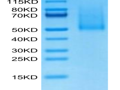 Cynomolgus CX3CL1/Fractalkine Protein (CX3-CM101)