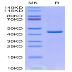 Human CXCL4L1 Protein (CXC-HM2L1)