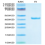 Human CXCL4 Protein (CXC-HM2L4)