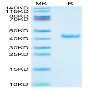 Human CXCL4 Protein (CXC-HM2L4)