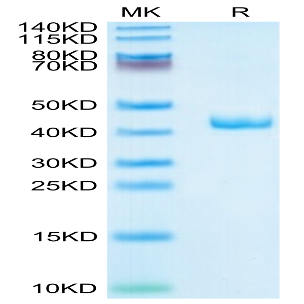Human CXCL4 Protein (CXC-HM2L4)