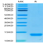 Human CXCL4 Protein (CXC-HM4L4)