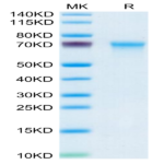 Mouse CXCL16 Protein (CXC-MM216)