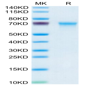 Mouse CXCL16 Protein (CXC-MM216)