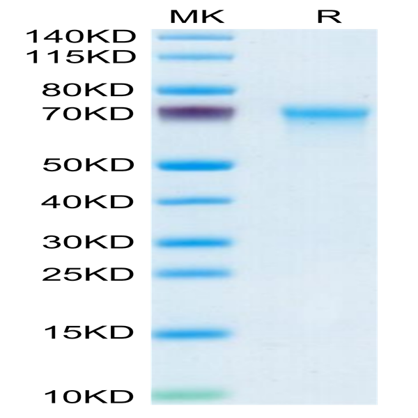 Mouse CXCL16 Protein (CXC-MM216)