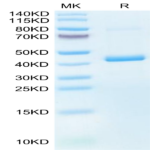 Mouse CXCL4 Protein (CXC-MM2L4)