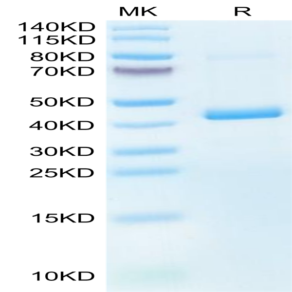 Mouse CXCL4 Protein (CXC-MM2L4)