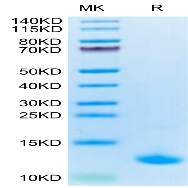 Cynomolgus CXCL10 Protein (CXL-CE110) Cynomolgus CXCL10 Protein (CXL-CE110)