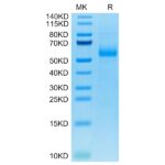 Cynomolgus AGER Protein, AER-CM101