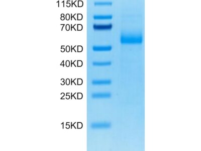Cynomolgus AGER Protein, AER-CM101 Ushelf