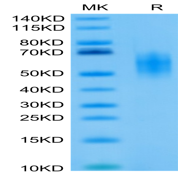 Biotinylated Human DNAM-1/CD226 Protein (DAM-HM101B)