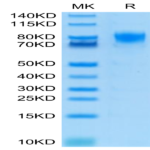 Human DNAM-1/CD226 Protein (DAM-HM201)