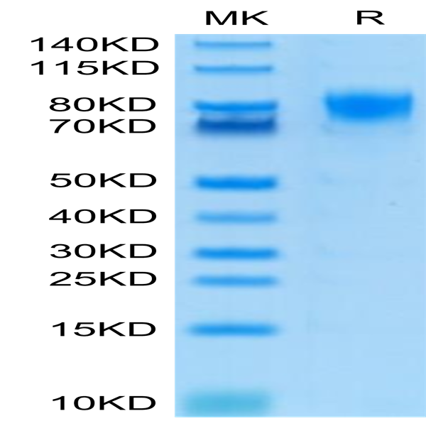 Human DNAM-1/CD226 Protein (DAM-HM201)