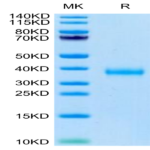 SARS-COV-2 Spike RBD (Delta B.1.617.2) Protein (DB1-VM1BD)