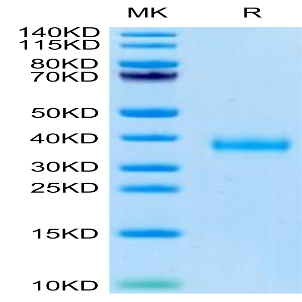 SARS-COV-2 Spike RBD (Delta B.1.617.2) Protein (DB1-VM1BD)
