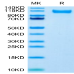 SARS-CoV-2 Spike S1 (Delta B.1.617.2) Protein (DB1-VM1S1)